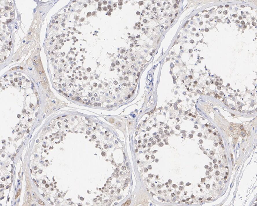 Immunohistochemistry: TopBP1 Antibody (PSH01-14) [NBP3-33036] - Immunohistochemical analysis of paraffin-embedded human testis tissue with Rabbit anti-TopBP1 antibody (NBP3-33036) at 1/200 dilution. The section was pre-treated using heat mediated antigen retrieval with sodium citrate buffer (pH 6.0) for 2 minutes. The tissues were blocked in 1% BSA for 20 minutes at room temperature, washed with ddH2O and PBS, and then probed with the primary antibody (NBP3-33036) at 1/200 dilution for 1 hour at room temperature. The detection was performed using an HRP conjugated compact polymer system. DAB was used as the chromogen. Tissues were counterstained with hematoxylin and mounted with DPX.