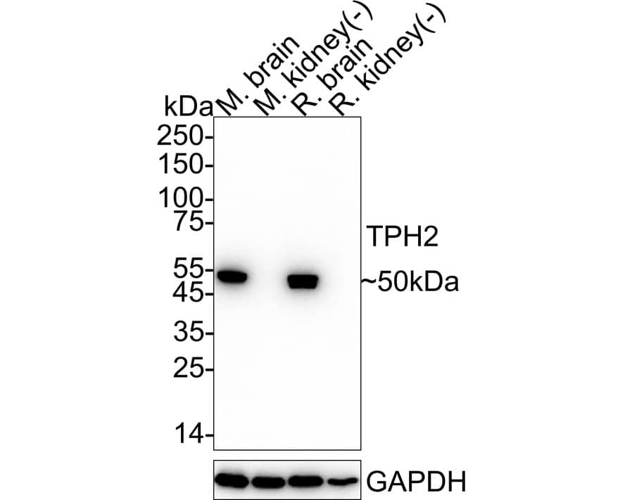 Western blot analysis on different lysates with NBP3-33037 at 1/2,000 dilution. Lane 1: Mouse brain tissue lysate Lane 2: Mouse kidney tissue lysate (negative) Lane 3: Rat brain tissue lysate Lane 4: Rat kidney tissue lysate (negative) Lysates/proteins at 20 µg/Lane. Predicted band size: 56 kDa Observed band size: 50 kDa Exposure time: 1 minute 2 seconds;  4-20% SDS-PAGE gel. Proteins were transferred to a PVDF membrane and blocked with 5% NFDM/TBST for 1 hour at room temperature. NBP3-33037 at 1/2,000 dilution was used in 5% NFDM/TBST at 4℃ overnight. Goat Anti-Rabbit IgG [HRP] Secondary Antibody at 1/50,000 dilution was used for 1 hour at room temperature.