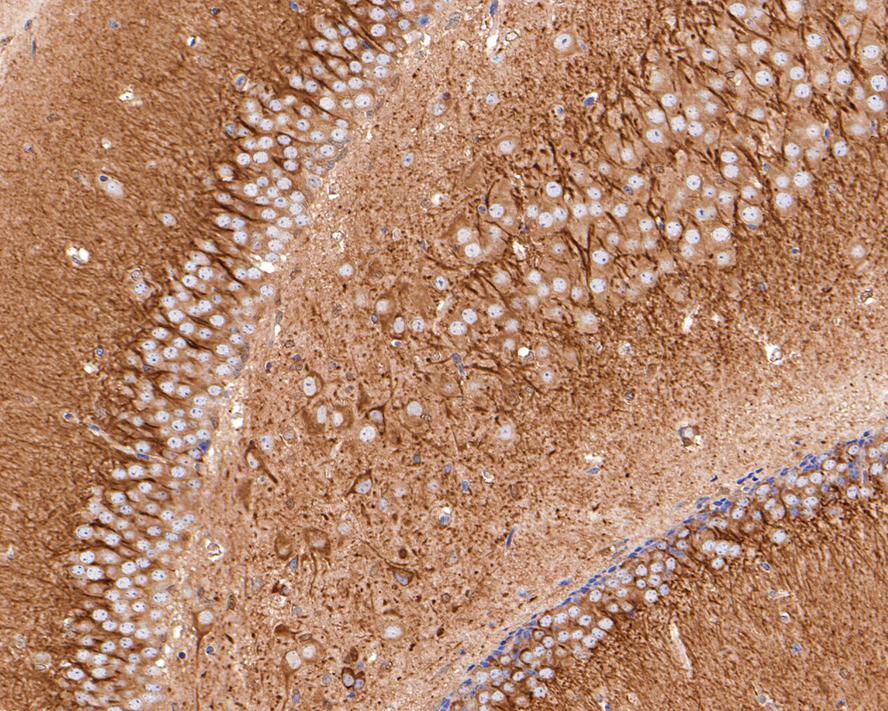Immunohistochemistry: TPMT Antibody (JE64-09) [NBP3-33038] - Immunohistochemical analysis of paraffin-embedded mouse hippocampus tissue with Rabbit anti-TPMT antibody (NBP3-33038) at 1/400 dilution. The section was pre-treated using heat mediated antigen retrieval with Tris-EDTA buffer (pH 9.0) for 20 minutes. The tissues were blocked in 1% BSA for 20 minutes at room temperature, washed with ddH2O and PBS, and then probed with the primary antibody (NBP3-33038) at 1/400 dilution for 1 hour at room temperature. The detection was performed using an HRP conjugated compact polymer system. DAB was used as the chromogen. Tissues were counterstained with hematoxylin and mounted with DPX.