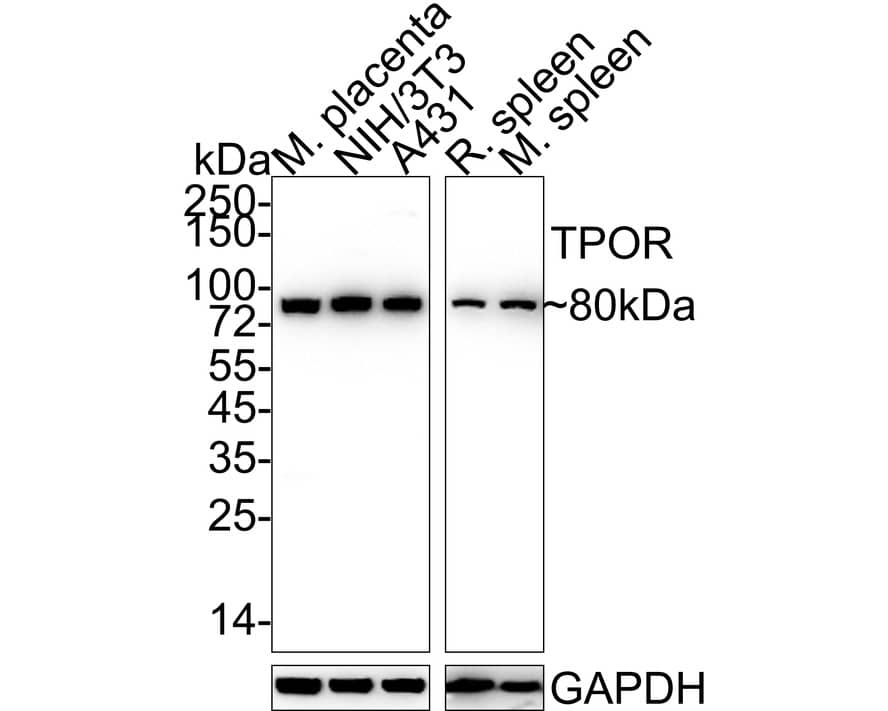 Western Blot: Thrombopoietin R/Tpo R Antibody (JE58-00) [NBP3-33039] - Western blot analysis of Thrombopoietin R/Tpo R on different lysates with Rabbit anti-Thrombopoietin R/Tpo R antibody (NBP3-33039) at 1/1,000 dilution. Lane 1: Mouse placenta tissue lysate (40 ug/Lane) Lane 2: NIH/3T3 cell lysate (20 ug/Lane) Lane 3: A431 cell lysate (no heat) (20 ug/Lane) Lane 4: Rat spleen tissue lysate (40 ug/Lane) Lane 5: Mouse spleen tissue lysate (40 ug/Lane) Predicted band size: 71 kDa Observed band size: 80 kDa Exposure time: Lane 1-3: 24 seconds; Lane 4-5: 30 seconds; 4-20% SDS-PAGE gel. Proteins were transferred to a PVDF membrane and blocked with 5% NFDM/TBST for 1 hour at room temperature. The primary antibody (NBP3-33039) at 1/1,000 dilution was used in 5% NFDM/TBST at 4C overnight. Goat Anti-Rabbit IgG - HRP Secondary Antibody at 1/50,000 dilution was used for 1 hour at room temperature.