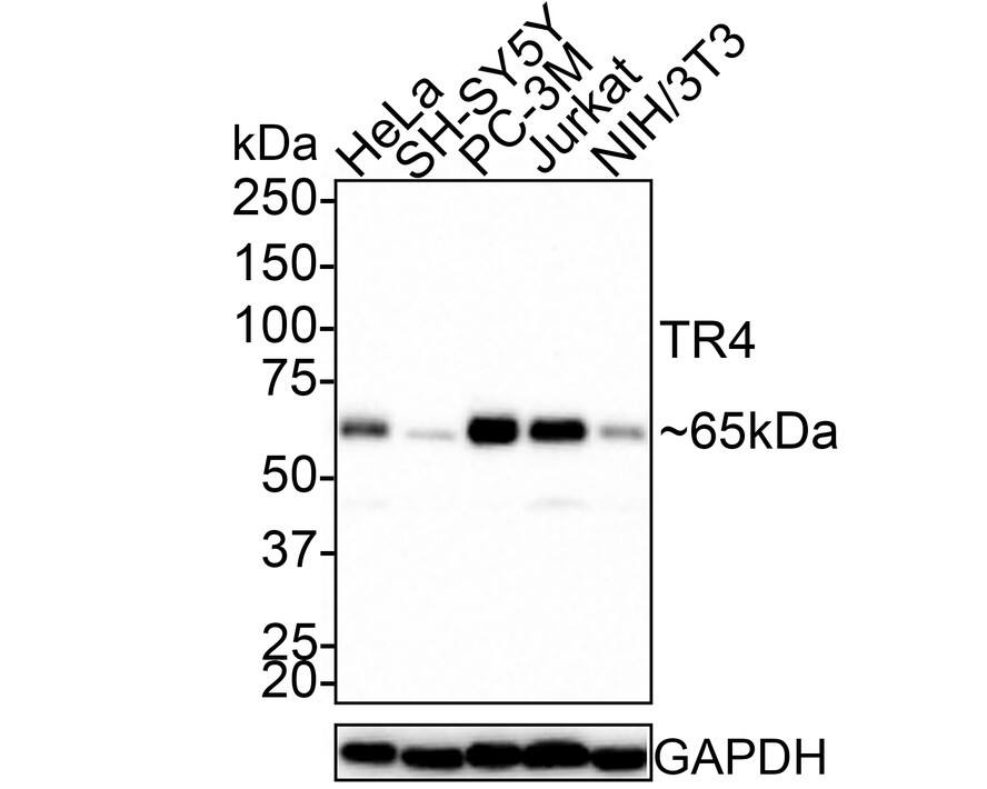 Western Blot: TR4/NR2C2 Antibody (JE45-03) [NBP3-33040] - Western blot analysis of TR4/NR2C2 on different lysates with Rabbit anti-TR4/NR2C2 antibody (NBP3-33040) at 1/1,000 dilution. Lane 1: Hela cell lysate Lane 2: SH-SY5Y cell lysate Lane 3: Jurkat cell lysate Lane 4: PC-3M cell lysate Lane 5: NIH/3T3 cell lysate Lysates/proteins at 15 ug/Lane. Predicted band size: 65 kDa Observed band size: 65 kDa Exposure time: 3 minutes; 4-20% SDS-PAGE gel. Proteins were transferred to a PVDF membrane and blocked with 5% NFDM/TBST for 1 hour at room temperature. The primary antibody (NBP3-33040) at 1/1,000 dilution was used in 5% NFDM/TBST at room temperature for 2 hours. Goat Anti-Rabbit IgG - HRP Secondary Antibody at 1:100,000 dilution was used for 1 hour at room temperature.