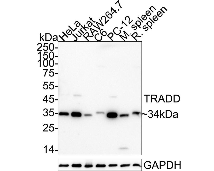 Western blot analysis on different lysates with NBP3-33041 at 1/1,000 dilution. Lane 1: HeLa cell lysate (20 µg/Lane) Lane 2: Jurkat cell lysate (20 µg/Lane) Lane 3: RAW264.7 cell lysate (20 µg/Lane) Lane 4: C6 cell lysate (20 µg/Lane) Lane 5: PC-12 cell lysate (20 µg/Lane) Lane 6: Mouse spleen tissue lysate (40 µg/Lane) Lane 7: Rat spleen tissue lysate (40 µg/Lane) Predicted band size: 34 kDa Observed band size: 34 kDa Exposure time: 1 minute 50 seconds;  4-20% SDS-PAGE gel. Proteins were transferred to a PVDF membrane and blocked with 5% NFDM/TBST for 1 hour at room temperature. NBP3-33041 at 1/1,000 dilution was used in primary antibody dilution at 4℃ overnight. Goat Anti-Rabbit IgG [HRP] Secondary Antibody at 1/50,000 dilution was used for 1 hour at room temperature.