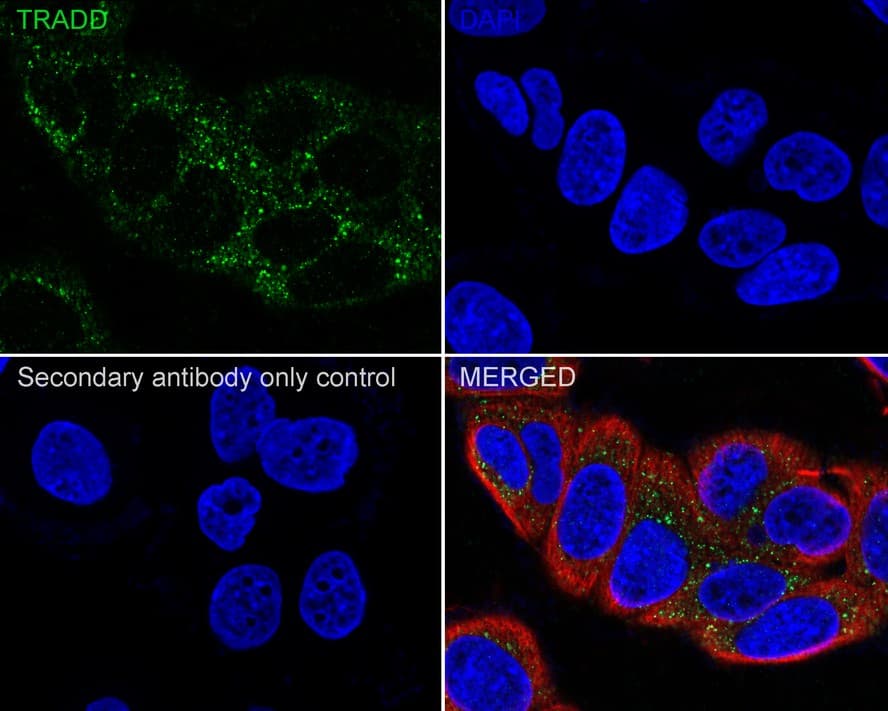 Immunocytochemistry/ Immunofluorescence: TRADD Antibody (JE32-60) [NBP3-33041] - Immunocytochemistry analysis of MCF7 cells labeling TRADD with Rabbit anti-TRADD antibody (NBP3-33041) at 1/100 dilution. Cells were fixed in 4% paraformaldehyde for 20 minutes at room temperature, permeabilized with 0.1% Triton X-100 in PBS for 5 minutes at room temperature, then blocked with 1% BSA in 10% negative goat serum for 1 hour at room temperature. Cells were then incubated with Rabbit anti-TRADD antibody (NBP3-33041) at 1/100 dilution in 1% BSA in PBST overnight at 4 ℃. Goat Anti-Rabbit IgG H&L (iFluor™ 488) was used as the secondary antibody at 1/1,000 dilution. PBS instead of the primary antibody was used as the secondary antibody only control. Nuclear DNA was labelled in blue with DAPI. Beta tubulin (red) was stained at 1/100 dilution overnight at +4℃. Goat Anti-Mouse IgG H&L (iFluor™ 594) was used as the secondary antibody at 1/1,000 dilution.