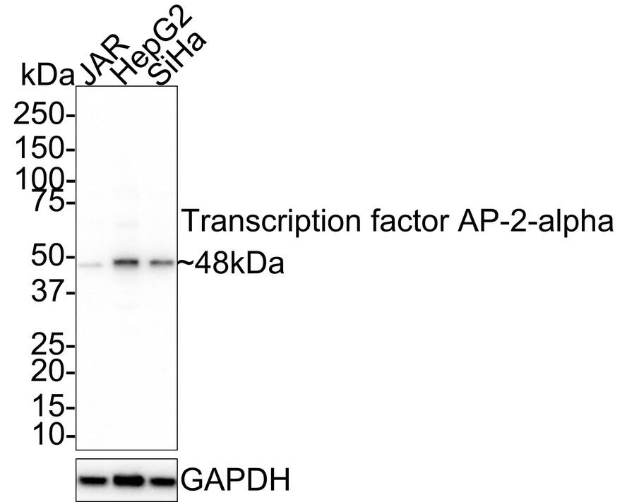 Western blot analysis on different lysates with NBP3-33043 at 1/1,000 dilution. Lane 1: JAR cell lysate Lane 2: HepG2 cell lysate Lane 3: SiHa cell lysate Lysates/proteins at 20 µg/Lane. Predicted band size: 48 kDa Observed band size: 48 kDa Exposure time: 5 minutes; 4-20% SDS-PAGE gel. Proteins were transferred to a PVDF membrane and blocked with 5% NFDM/TBST for 1 hour at room temperature. NBP3-33043 at 1/1,000 dilution was used in 5% NFDM/TBST at 4℃ overnight. Goat Anti-Rabbit IgG [HRP] Secondary Antibody at 1/50,000 dilution was used for 1 hour at room temperature.