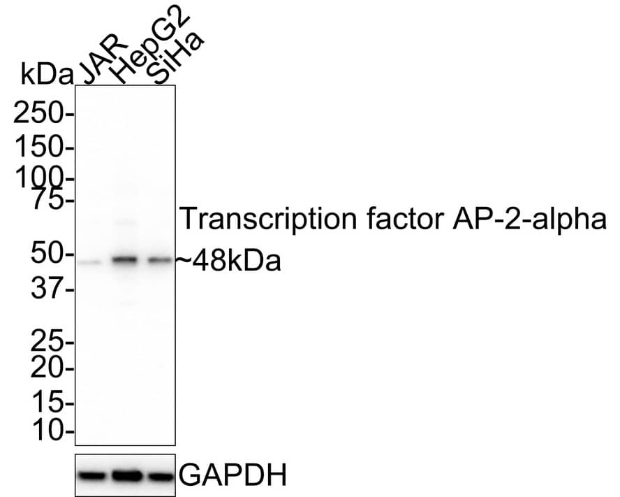 Western Blot: AP2 alpha Antibody (PSH02-05) [NBP3-33043] - Western blot analysis of AP2 alpha on different lysates with Rabbit anti-AP2 alpha antibody (NBP3-33043) at 1/1,000 dilution. Lane 1: JAR cell lysate Lane 2: HepG2 cell lysate Lane 3: SiHa cell lysate Lysates/proteins at 20 ug/Lane. Predicted band size: 48 kDa Observed band size: 48 kDa Exposure time: 5 minutes; 4-20% SDS-PAGE gel. Proteins were transferred to a PVDF membrane and blocked with 5% NFDM/TBST for 1 hour at room temperature. The primary antibody (NBP3-33043) at 1/1,000 dilution was used in 5% NFDM/TBST at 4C overnight. Goat Anti-Rabbit IgG - HRP Secondary Antibody at 1/50,000 dilution was used for 1 hour at room temperature.