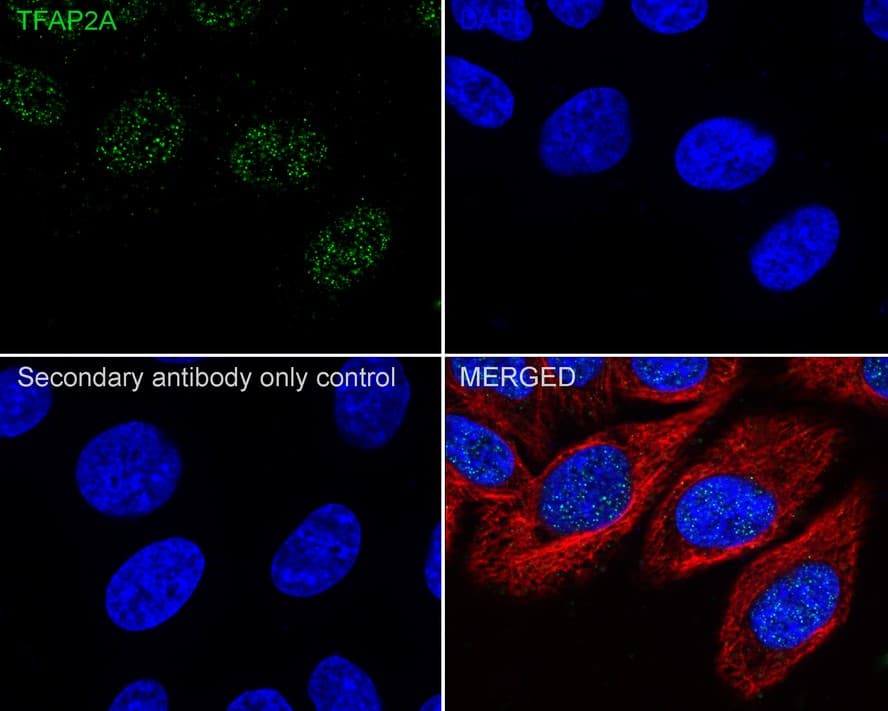 Immunocytochemistry/ Immunofluorescence: AP2 alpha Antibody (PSH02-05) [NBP3-33043] - Immunocytochemistry analysis of HepG2 cells labeling AP2 alpha with Rabbit anti-AP2 alpha antibody (NBP3-33043) at 1/100 dilution. Cells were fixed in 4% paraformaldehyde for 20 minutes at room temperature, permeabilized with 0.1% Triton X-100 in PBS for 5 minutes at room temperature, then blocked with 1% BSA in 10% negative goat serum for 1 hour at room temperature. Cells were then incubated with Rabbit anti-AP2 alpha antibody (NBP3-33043) at 1/100 dilution in 1% BSA in PBST overnight at 4 ℃. Goat Anti-Rabbit IgG H&L (iFluor™ 488) was used as the secondary antibody at 1/1,000 dilution. PBS instead of the primary antibody was used as the secondary antibody only control. Nuclear DNA was labelled in blue with DAPI. Beta tubulin (red) was stained at 1/100 dilution overnight at +4℃. Goat Anti-Mouse IgG H&L (iFluor™ 594) was used as the secondary antibody at 1/1,000 dilution.