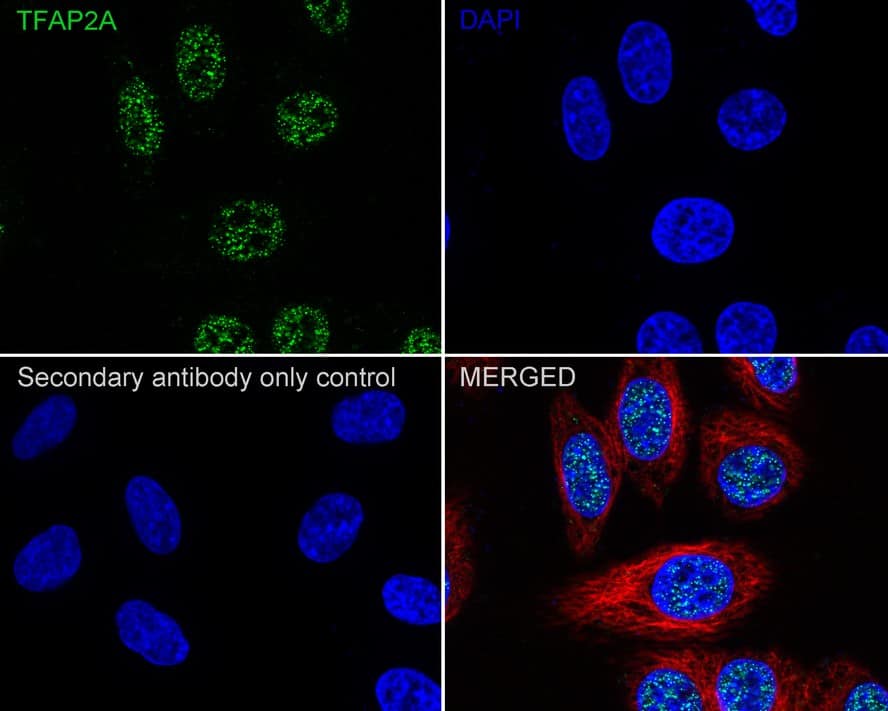 Immunocytochemistry/ Immunofluorescence: AP2 alpha Antibody (PSH02-06) [NBP3-33044] - Immunocytochemistry analysis of HepG2 cells labeling AP2 alpha with Rabbit anti-AP2 alpha antibody (NBP3-33044) at 1/100 dilution. Cells were fixed in 4% paraformaldehyde for 20 minutes at room temperature, permeabilized with 0.1% Triton X-100 in PBS for 5 minutes at room temperature, then blocked with 1% BSA in 10% negative goat serum for 1 hour at room temperature. Cells were then incubated with Rabbit anti-AP2 alpha antibody (NBP3-33044) at 1/100 dilution in 1% BSA in PBST overnight at 4 ℃. Goat Anti-Rabbit IgG H&L (iFluor™ 488) was used as the secondary antibody at 1/1,000 dilution. PBS instead of the primary antibody was used as the secondary antibody only control. Nuclear DNA was labelled in blue with DAPI. Beta tubulin (red) was stained at 1/100 dilution overnight at +4℃. Goat Anti-Mouse IgG H&L (iFluor™ 594) was used as the secondary antibody at 1/1,000 dilution.