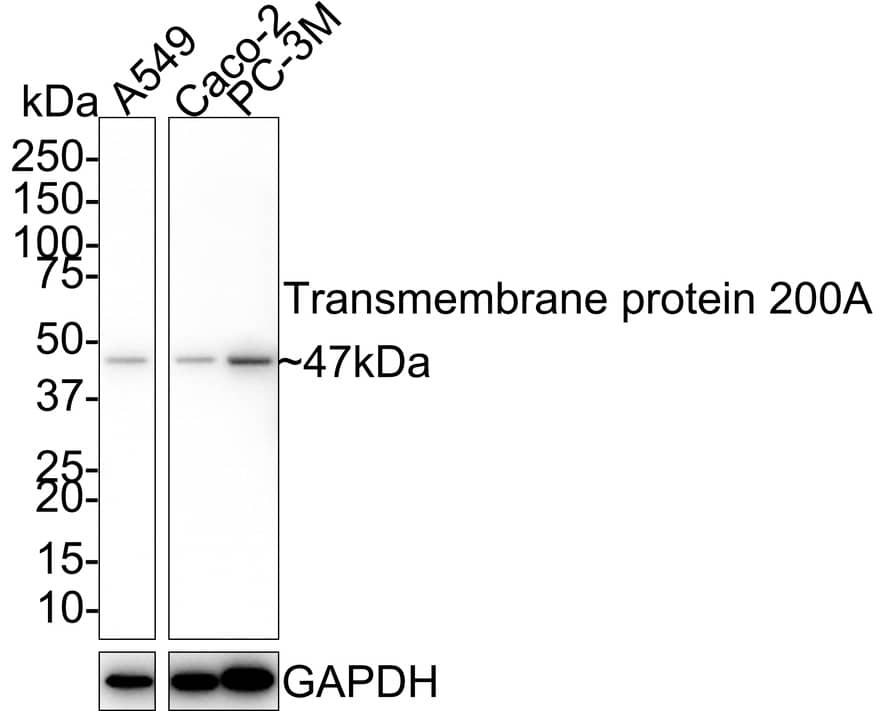Western Blot TMEM200A Antibody (4-B3-R)
