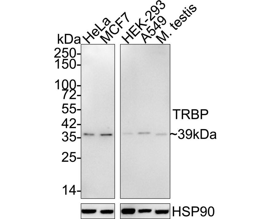 Western blot analysis on different lysates with NBP3-33046 at 1/1,000 dilution. Lane 1: HeLa cell lysate (15 µg/Lane) Lane 2: MCF7 cell lysate (15 µg/Lane) Lane 3: HEK-293 cell lysate (15 µg/Lane) Lane 4: A549 cell lysate (15 µg/Lane) Lane 5: Mouse testis tissue lysate (30 µg/Lane) Predicted band size: 39 kDa Observed band size: 39 kDa Exposure time: 3 minutes 10 seconds; 4-20% SDS-PAGE gel. Proteins were transferred to a PVDF membrane and blocked with 5% NFDM/TBST for 1 hour at room temperature. NBP3-33046 at 1/1,000 dilution was used in 5% NFDM/TBST at room temperature for 2 hours. Goat Anti-Rabbit IgG [HRP] Secondary Antibody at 1/50,000 dilution was used for 1 hour at room temperature.
