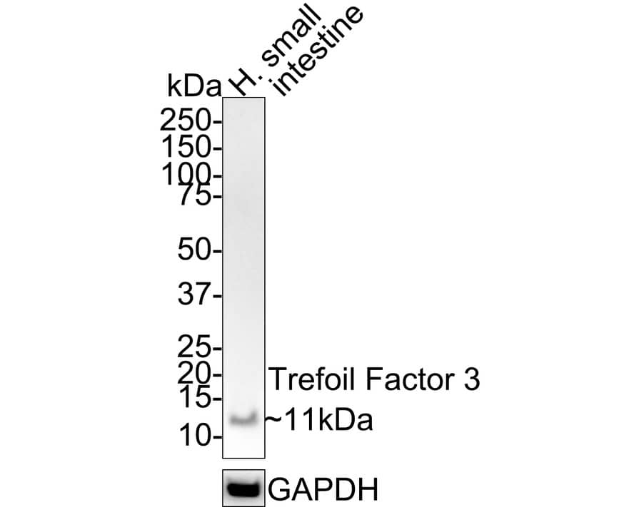 Western Blot: TFF3 Antibody (JE32-01) [NBP3-33047] - Western blot analysis of TFF3 on human small intestine tissue lysates with Rabbit anti-TFF3 antibody (NBP3-33047) at 1/1,000 dilution. Lysates/proteins at 30 ug/Lane. Predicted band size: 8 kDa Observed band size: 11 kDa Exposure time: 3 minutes; 4-20% SDS-PAGE gel. Proteins were transferred to a PVDF membrane and blocked with 5% NFDM/TBST for 1 hour at room temperature. The primary antibody (NBP3-33047) at 1/1,000 dilution was used in 5% NFDM/TBST at 4C overnight. Goat Anti-Rabbit IgG - HRP Secondary Antibody at 1:100,000 dilution was used for 1 hour at room temperature.