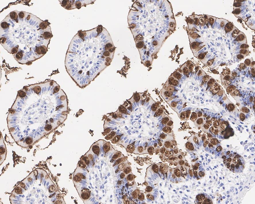 Immunohistochemistry: TFF3 Antibody (JE32-01) [NBP3-33047] - Immunohistochemical analysis of paraffin-embedded human small intestine tissue with Rabbit anti-TFF3 antibody (NBP3-33047) at 1/1,000 dilution. The section was pre-treated using heat mediated antigen retrieval with Tris-EDTA buffer (pH 9.0) for 20 minutes. The tissues were blocked in 1% BSA for 20 minutes at room temperature, washed with ddH2O and PBS, and then probed with the primary antibody (NBP3-33047) at 1/1,000 dilution for 1 hour at room temperature. The detection was performed using an HRP conjugated compact polymer system. DAB was used as the chromogen. Tissues were counterstained with hematoxylin and mounted with DPX.