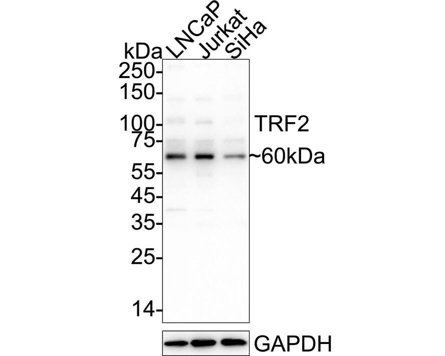 Western blot analysis on different lysates with NBP3-33049 at 1/1,000 dilution. Lane 1: LNCaP cell lysate Lane 2: Jurkat cell lysate Lane 3: SiHa cell lysate Lysates/proteins at 20 µg/Lane. Predicted band size: 60 kDa Observed band size: 60 kDa Exposure time: 25 seconds;  4-20% SDS-PAGE gel. Proteins were transferred to a PVDF membrane and blocked with 5% NFDM/TBST for 1 hour at room temperature. NBP3-33049 at 1/1,000 dilution was used in primary antibody dilution at 4℃ overnight. Goat Anti-Rabbit IgG [HRP] Secondary Antibody at 1/50,000 dilution was used for 1 hour at room temperature.