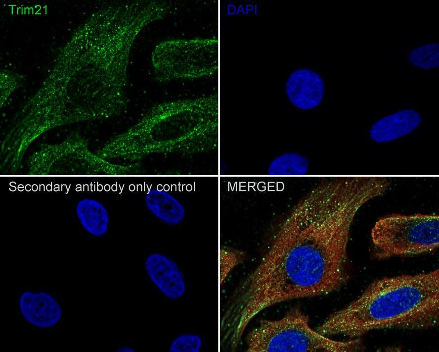 Immunocytochemistry/ Immunofluorescence: TRIM21/SSA1 Antibody (PSH02-56) [NBP3-33051] - Immunocytochemistry analysis of U-2 OS cells labeling TRIM21/SSA1 with Rabbit anti-TRIM21/SSA1 antibody (NBP3-33051) at 1/100 dilution. Cells were fixed in 4% paraformaldehyde for 20 minutes at room temperature, permeabilized with 0.1% Triton X-100 in PBS for 5 minutes at room temperature, then blocked with 1% BSA in 10% negative goat serum for 1 hour at room temperature. Cells were then incubated with Rabbit anti-TRIM21/SSA1 antibody (NBP3-33051) at 1/100 dilution in 1% BSA in PBST overnight at 4 ℃. Goat Anti-Rabbit IgG H&L (iFluor™ 488) was used as the secondary antibody at 1/1,000 dilution. PBS instead of the primary antibody was used as the secondary antibody only control. Nuclear DNA was labelled in blue with DAPI. Beta tubulin (red) was stained at 1/100 dilution overnight at +4℃. Goat Anti-Mouse IgG H&L (iFluor™ 594) was used as the secondary antibody at 1/1,000 dilution.