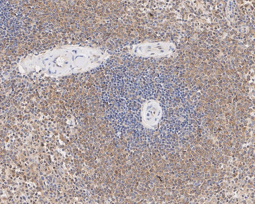 Immunohistochemistry: TRIM21/SSA1 Antibody (PSH02-56) [NBP3-33051] - Immunohistochemical analysis of paraffin-embedded human spleen tissue with Rabbit anti-TRIM21/SSA1 antibody (NBP3-33051) at 1/1,000 dilution. The section was pre-treated using heat mediated antigen retrieval with Tris-EDTA buffer (pH 9.0) for 20 minutes. The tissues were blocked in 1% BSA for 20 minutes at room temperature, washed with ddH2O and PBS, and then probed with the primary antibody (NBP3-33051) at 1/1,000 dilution for 1 hour at room temperature. The detection was performed using an HRP conjugated compact polymer system. DAB was used as the chromogen. Tissues were counterstained with hematoxylin and mounted with DPX.