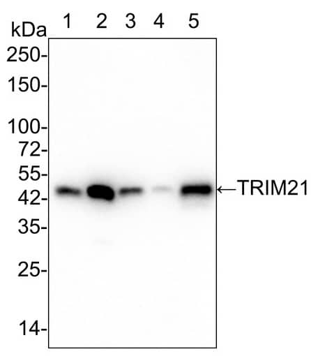 Western Blot: TRIM21/SSA1 Antibody (PSH02-56) [NBP3-33051] - Western blot analysis of TRIM21/SSA1 on different lysates with Rabbit anti-TRIM21/SSA1 antibody (NBP3-33051) at 1/10,000 dilution. Lane 1: HeLa cell lysate Lane 2: HeLa treated with 10ng/mL IFN-alpha  for 16 hours cell lysate Lane 3: A549 cell lysate Lane 4: 293T cell lysate Lane 5: U-2 OS cell lysate Lysates/proteins at 15 µg/Lane. Predicted band size: 54 kDa Observed band size: 50 kDa Exposure time: 30 seconds; 4-20% SDS-PAGE gel. Proteins were transferred to a PVDF membrane and blocked with 5% NFDM/TBST for 1 hour at room temperature. The primary antibody at 1/10,000 dilution was used in 5% NFDM/TBST at 4℃ overnight. Goat Anti-Rabbit IgG - HRP Secondary Antibody at 1/50,000 dilution was used for 1 hour at room temperature.