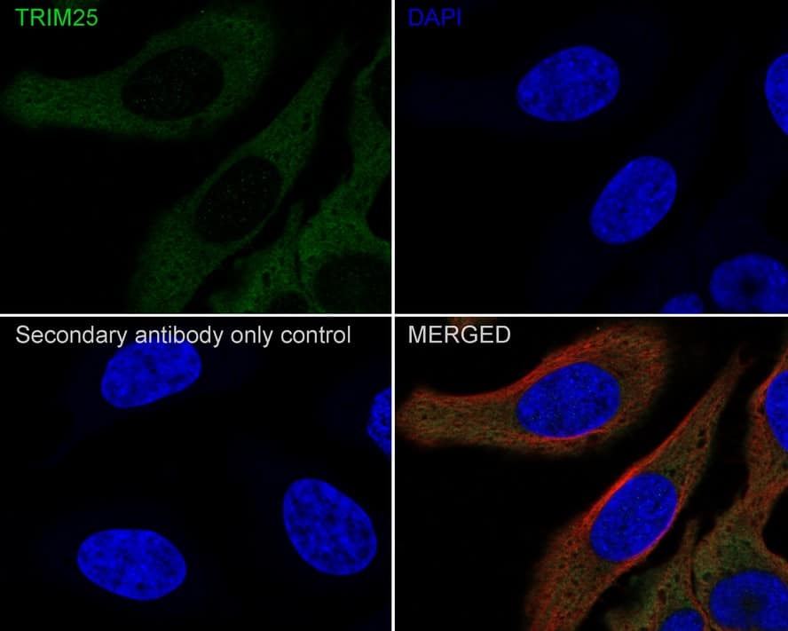 Immunocytochemistry/ Immunofluorescence: TRIM25 Antibody (JE57-43) [NBP3-33053] - Immunocytochemistry analysis of HeLa cells labeling TRIM25 with Rabbit anti-TRIM25 antibody (NBP3-33053) at 1/100 dilution. Cells were fixed in 4% paraformaldehyde for 20 minutes at room temperature, permeabilized with 0.1% Triton X-100 in PBS for 5 minutes at room temperature, then blocked with 1% BSA in 10% negative goat serum for 1 hour at room temperature. Cells were then incubated with Rabbit anti-TRIM25 antibody (NBP3-33053) at 1/100 dilution in 1% BSA in PBST overnight at 4 ℃. Goat Anti-Rabbit IgG H&L (iFluor™ 488) was used as the secondary antibody at 1/1,000 dilution. PBS instead of the primary antibody was used as the secondary antibody only control. Nuclear DNA was labelled in blue with DAPI. Beta tubulin (red) was stained at 1/100 dilution overnight at +4℃. Goat Anti-Mouse IgG H&L (iFluor™ 594) was used as the secondary antibody at 1/1,000 dilution.