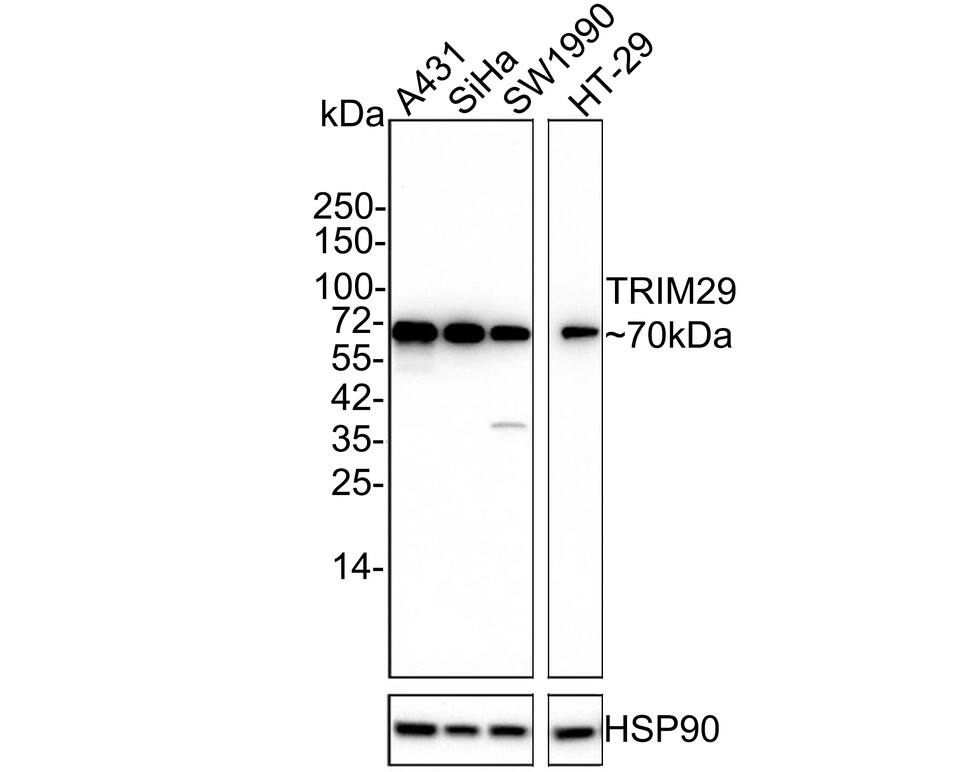 Western blot analysis on different lysates with NBP3-33054 at 1/1,000 dilution. Lane 1: A431 cell lysate Lane 2: SiHa cell lysate Lane 3: SW1990 cell lysate Lane 4: HT-29 cell lysate Lysates/proteins at 20 µg/Lane. Predicted band size: 66 kDa Observed band size: 70 kDa Exposure time: 5 minutes; 4-20% SDS-PAGE gel. Proteins were transferred to a PVDF membrane and blocked with 5% NFDM/TBST for 1 hour at room temperature. NBP3-33054 at 1/2,000 dilution was used in 5% NFDM/TBST at 4℃ overnight. Goat Anti-Rabbit IgG [HRP] Secondary Antibody at 1/50,000 dilution was used for 1 hour at room temperature.