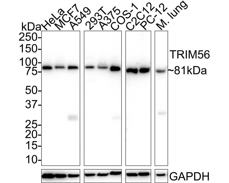 Western Blot TRIM56 Antibody (PSH02-17)