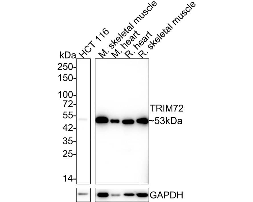 Western blot analysis on different lysates with NBP3-33056 at 1/1,000 dilution. Lane 1: HCT 116 cell lysate (20 µg/Lane) Lane 2: Mouse skeletal muscle tissue lysate (40 µg/Lane) Lane 3: Mouse heart tissue lysate (40 µg/Lane) Lane 4: Rat heart tissue lysate (40 µg/Lane) Lane 5: Rat skeletal muscle tissue lysate (40 µg/Lane) Predicted band size: 53 kDa Observed band size: 53 kDa Exposure time: 1 minute 40 seconds; 4-20% SDS-PAGE gel. Proteins were transferred to a PVDF membrane and blocked with 5% NFDM/TBST for 1 hour at room temperature. NBP3-33056 at 1/1,000 dilution was used in 5% NFDM/TBST at 4℃ overnight. Goat Anti-Mouse IgG Secondary Antibody at 1/5,000 dilution was used for 1 hour at room temperature.