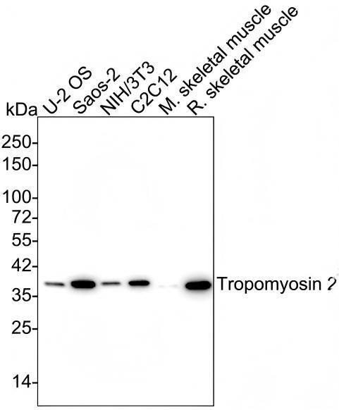 Western blot analysis on different lysates with NBP3-33059 at 1/1,000 dilution and competitor's antibody at 1/1,000 dilution. Lane 1: U-2 OS cell lysate Lane 2: Saos-2 cell lysate Lane 3: NIH/3T3 cell lysate Lane 4: C2C12 cell lysate Lane 5: Mouse skeletal muscle tissue lysate Lane 6: Rat skeletal muscle tissue lysate Lysates/proteins at 20 µg/Lane. Predicted band size: 33 kDa Observed band size: 37 kDa Exposure time: 3 minutes;  4-20% SDS-PAGE gel. Proteins were transferred to a PVDF membrane and blocked with 5% NFDM/TBST for 1 hour at room temperature. NBP3-33059 at 1/1,000 dilution and competitor's antibody at 1/1,000 dilution were used in 5% NFDM/TBST at 4℃ overnight. Goat Anti-Rabbit IgG [HRP] Secondary Antibody at 1/50,000 dilution was used for 1 hour at room temperature.