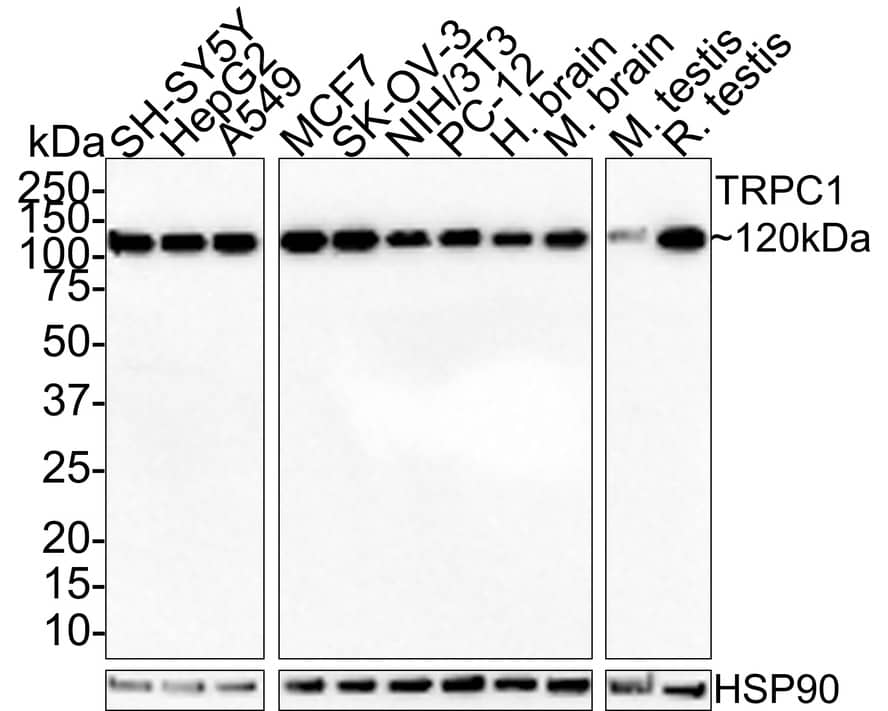 Western Blot: TRPC1 Antibody (JE35-25) [NBP3-33060] - Western blot analysis of TRPC1 on different lysates with Rabbit anti-TRPC1 antibody (NBP3-33060) at 1/1,000 dilution. Lane 1: SH-SY5Y cell lysate 15 ug/Lane) Lane 2: HepG2 cell lysate 15 ug/Lane) Lane 3: A549 cell lysate 15 ug/Lane) Lane 4: MCF7 cell lysate 15 ug/Lane) Lane 5: SK-OV-3 cell lysate 15 ug/Lane) Lane 6: NIH/3T3 cell lysate 15 ug/Lane) Lane 7: PC-12 cell lysate 15 ug/Lane) Lane 8: Human brain tissue lysate (30 ug/Lane) Lane 9: Mosue brain tissue lysate (30 ug/Lane) Lane 10: Mosue testis tissue lysate (30 ug/Lane) Lane 11: Rat testis tissue lysate (30 ug/Lane) Predicted band size: 91 kDa Observed band size: 120 kDa Exposure time: 3 minutes; 4-20% SDS-PAGE gel. Proteins were transferred to a PVDF membrane and blocked with 5% NFDM/TBST for 1 hour at room temperature. The primary antibody (NBP3-33060) at 1/1,000 dilution was used in 5% NFDM/TBST at room temperature for 2 hours. Goat Anti-Rabbit IgG - HRP Secondary Antibody at 1:100,000 dilution was used for 1 hour at room temperature.