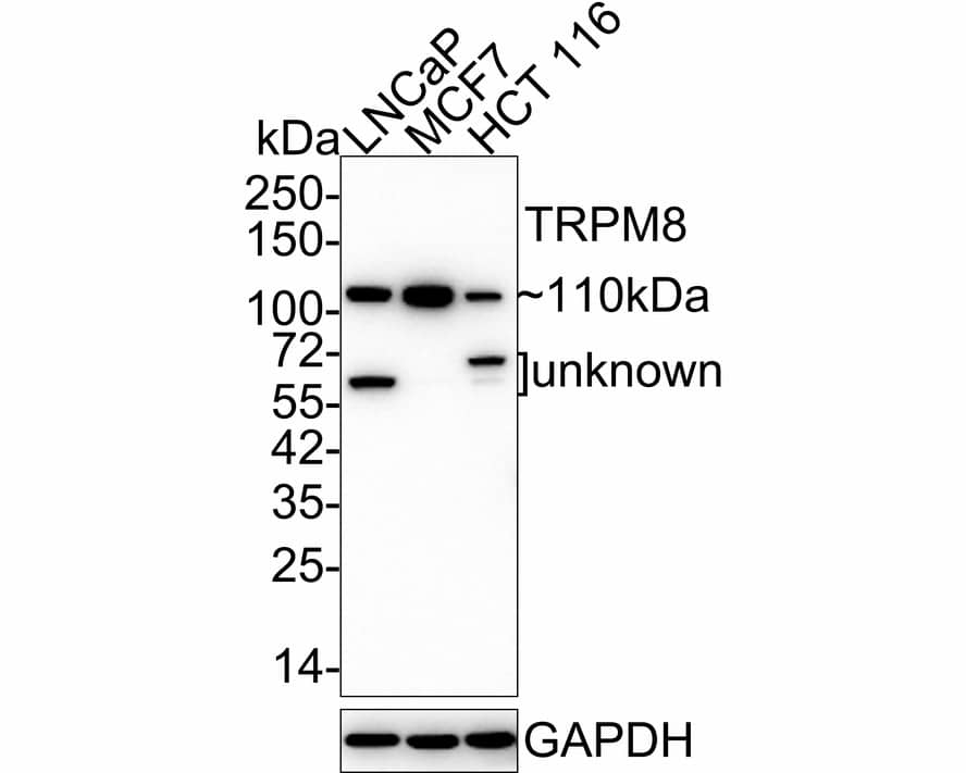 Western Blot: TRPM8 Antibody (JE32-58) [NBP3-33062] - Western blot analysis of TRPM8 on different lysates with Rabbit anti-TRPM8 antibody (NBP3-33062) at 1/1,000 dilution. Lane 1: LNCaP cell lysate Lane 2: MCF7 cell lysate Lane 3: HCT 116 cell lysate Lysates/proteins at 20 ug/Lane. Predicted band size: 128 kDa Observed band size: 110 kDa Exposure time: 3 minutes; 4-20% SDS-PAGE gel. Proteins were transferred to a PVDF membrane and blocked with 5% NFDM/TBST for 1 hour at room temperature. The primary antibody (NBP3-33062) at 1/1,000 dilution was used in 5% NFDM/TBST at 4C overnight. Goat Anti-Rabbit IgG - HRP Secondary Antibody at 1/50,000 dilution was used for 1 hour at room temperature.