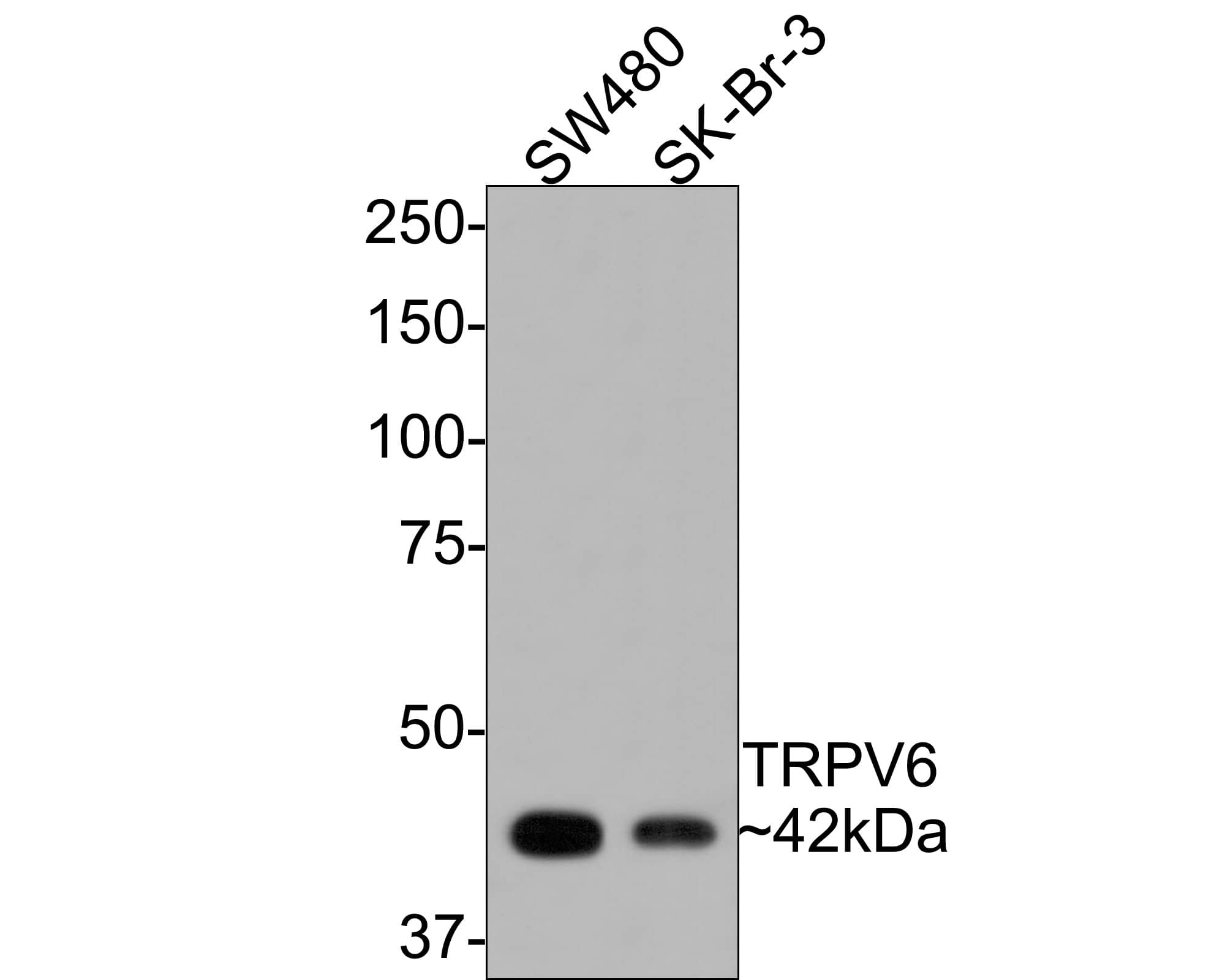 Western blot analysis on different lysates with NBP3-33063 at 1/500 dilution. Lane 1: SW480 cell lysate Lane 2: SK-Br-3 cell lysate Lysates/proteins at 10 µg/Lane. Predicted band size: 87 kDa Observed band size: 42 kDa (unglycosylated monomeric form of TRPV6) Exposure time: 30 seconds; 8% SDS-PAGE gel. Proteins were transferred to a PVDF membrane and blocked with 5% NFDM/TBST for 1 hour at room temperature. NBP3-33063 at 1/500 dilution was used in 5% NFDM/TBST at room temperature for 2 hours. Goat Anti-Rabbit IgG [HRP] Secondary Antibody at 1:300,000 dilution was used for 1 hour at room temperature.