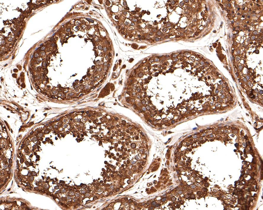 Immunohistochemistry: alpha Tubulin 3c Antibody [NBP3-33065] - Immunohistochemical analysis of paraffin-embedded human testis tissue with Rabbit anti-alpha Tubulin 3c antibody (NBP3-33065) at 1/1,000 dilution. The section was pre-treated using heat mediated antigen retrieval with Tris-EDTA buffer (pH 9.0) for 20 minutes. The tissues were blocked in 1% BSA for 20 minutes at room temperature, washed with ddH2O and PBS, and then probed with the primary antibody (NBP3-33065) at 1/1,000 dilution for 1 hour at room temperature. The detection was performed using an HRP conjugated compact polymer system. DAB was used as the chromogen. Tissues were counterstained with hematoxylin and mounted with DPX.