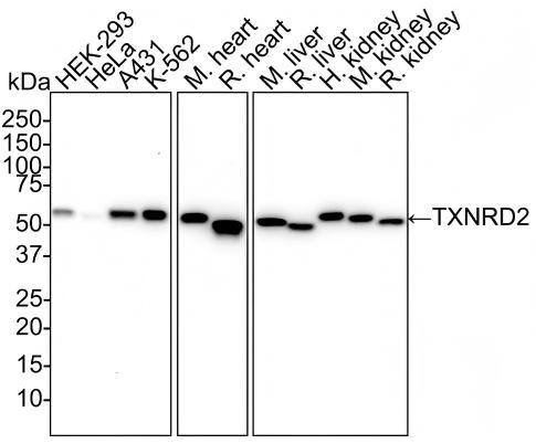 Western blot analysis on different lysates with NBP3-33068 at 1/1,000 dilution and competitor's antibody at 1/1,000 dilution. Lane 1: HEK-293 cell lysate (20 µg/Lane) Lane 2: HeLa cell lysate (20 µg/Lane) Lane 3: A431 cell lysate (20 µg/Lane) Lane 4: K-562 cell lysate (20 µg/Lane) Lane 5: Mouse heart tissue lysate (40 µg/Lane) Lane 6: Rat heart tissue lysate (40 µg/Lane) Lane 7: Mouse liver tissue lysate (40 µg/Lane) Lane 8: Rat liver tissue lysate (40 µg/Lane) Lane 9: Human kidney tissue lysate (40 µg/Lane) Lane 10: Mouse kidney tissue lysate (40 µg/Lane) Lane 11: Rat kidney tissue lysate (40 µg/Lane) Predicted band size: 57 kDa Observed band size: 57 kDa Exposure time: 3 minutes;  4-20% SDS-PAGE gel. Proteins were transferred to a PVDF membrane and blocked with 5% NFDM/TBST for 1 hour at room temperature. NBP3-33068 at 1/1,000 dilution and competitor's antibody at 1/1,000 dilution were used in 5% NFDM/TBST at 4℃ overnight. Goat Anti-Rabbit IgG [HRP] Secondary Antibody at 1/50,000 dilution was used for 1 hour at room temperature.