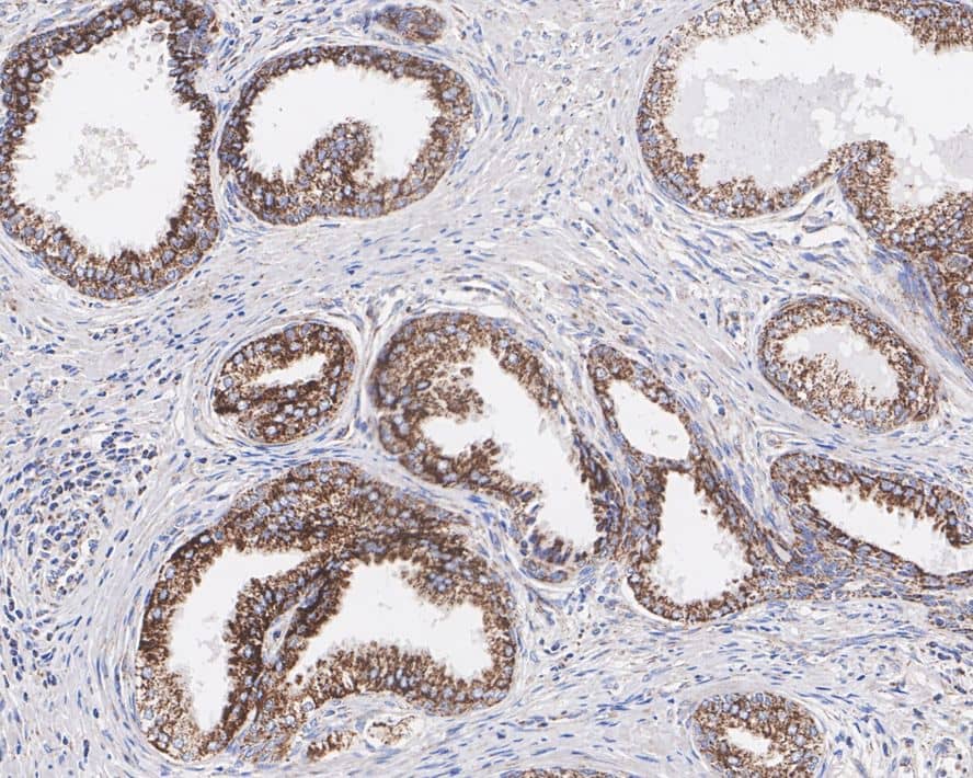 Immunohistochemistry: TXNRD2 Antibody (PSH02-26) [NBP3-33068] - Immunohistochemical analysis of paraffin-embedded human prostate tissue with Rabbit anti-TXNRD2 antibody (NBP3-33068) at 1/1,000 dilution. The section was pre-treated using heat mediated antigen retrieval with Tris-EDTA buffer (pH 9.0) for 20 minutes. The tissues were blocked in 1% BSA for 20 minutes at room temperature, washed with ddH2O and PBS, and then probed with the primary antibody (NBP3-33068) at 1/1,000 dilution for 1 hour at room temperature. The detection was performed using an HRP conjugated compact polymer system. DAB was used as the chromogen. Tissues were counterstained with hematoxylin and mounted with DPX.