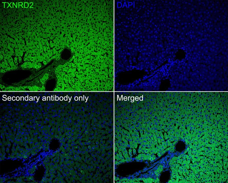 Immunohistochemistry: TXNRD2 Antibody (PSH02-26) [NBP3-33068] - Immunofluorescence analysis of paraffin-embedded rat liver tissue labeling TXNRD2 with Rabbit anti-TXNRD2 antibody (NBP3-33068) at 1/50 dilution. The section was pre-treated using heat mediated antigen retrieval with Tris-EDTA buffer (pH 9.0) for 20 minutes. The tissues were blocked in 10% negative goat serum for 1 hour at room temperature, washed with PBS, and then probed with the primary antibody (NBP3-33068, green) at 1/50 dilution overnight at 4 ℃, washed with PBS. Goat Anti-Rabbit IgG H&L (iFluor™ 488) was used as the secondary antibody at 1/1,000 dilution. Nuclei were counterstained with DAPI (blue).