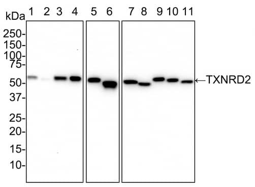 Western Blot: TXNRD2 Antibody (PSH02-26) [NBP3-33068] - Western blot analysis of TXNRD2 on different lysates with Rabbit anti-TXNRD2 antibody (NBP3-33068) at 1/1,000 dilution. Lane 1: HEK-293 cell lysate (20 µg/Lane) Lane 2: HeLa cell lysate (20 µg/Lane) Lane 3: A431 cell lysate (20 µg/Lane) Lane 4: K-562 cell lysate (20 µg/Lane) Lane 5: Mouse heart tissue lysate (40 µg/Lane) Lane 6: Rat heart tissue lysate (40 µg/Lane) Lane 7: Mouse liver tissue lysate (40 µg/Lane) Lane 8: Rat liver tissue lysate (40 µg/Lane) Lane 9: Human kidney tissue lysate (40 µg/Lane) Lane 10: Mouse kidney tissue lysate (40 µg/Lane) Lane 11: Rat kidney tissue lysate (40 µg/Lane) Predicted band size: 57 kDa Observed band size: 57 kDa Exposure time: 3 minutes; 4-20% SDS-PAGE gel. Proteins were transferred to a PVDF membrane and blocked with 5% NFDM/TBST for 1 hour at room temperature. The primary antibody at 1/1,000 dilution was used in 5% NFDM/TBST at 4℃ overnight. Goat Anti-Rabbit IgG - HRP Secondary Antibody at 1/50,000 dilution was used for 1 hour at room temperature.