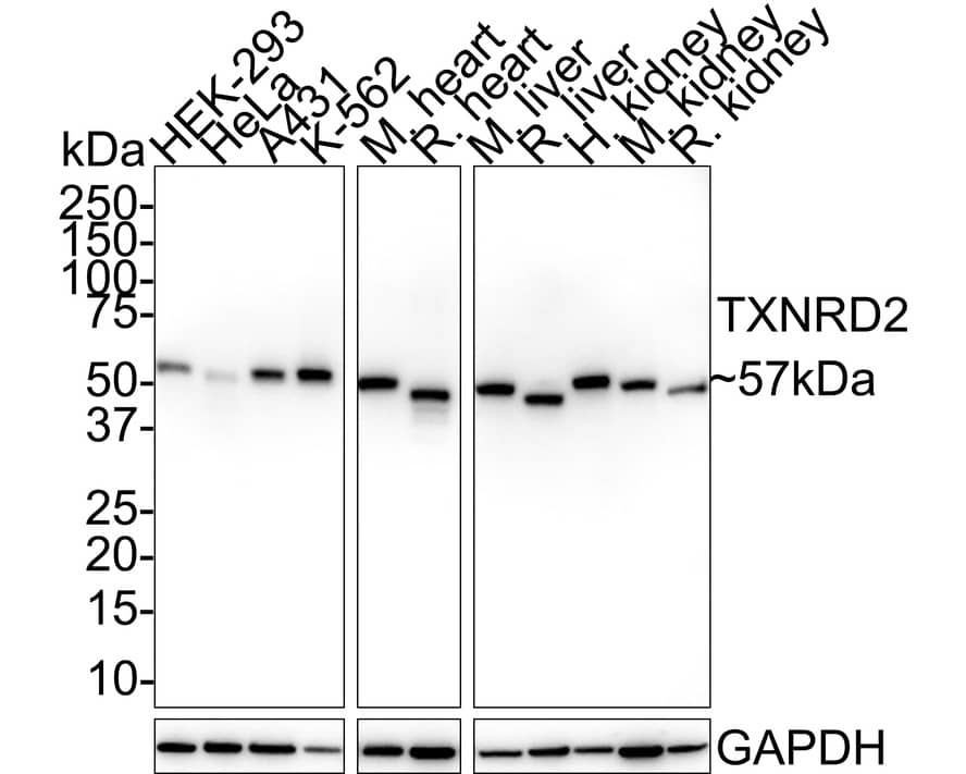 Western Blot: TXNRD2 Antibody (PSH02-27) [NBP3-33069] - Western blot analysis of TXNRD2 on different lysates with Rabbit anti-TXNRD2 antibody (NBP3-33069) at 1/1,000 dilution. Lane 1: HEK-293 cell lysate (20 ug/Lane) Lane 2: HeLa cell lysate (20 ug/Lane) Lane 3: A431 cell lysate (20 ug/Lane) Lane 4: K-562 cell lysate (20 ug/Lane) Lane 5: Mouse heart tissue lysate (40 ug/Lane) Lane 6: Rat heart tissue lysate (40 ug/Lane) Lane 7: Mouse liver tissue lysate (40 ug/Lane) Lane 8: Rat liver tissue lysate (40 ug/Lane) Lane 9: Human kidney tissue lysate (40 ug/Lane) Lane 10: Mouse kidney tissue lysate (40 ug/Lane) Lane 11: Rat kidney tissue lysate (40 ug/Lane) Predicted band size: 57 kDa Observed band size: 57 kDa Exposure time: 30 seconds; 4-20% SDS-PAGE gel. Proteins were transferred to a PVDF membrane and blocked with 5% NFDM/TBST for 1 hour at room temperature. The primary antibody (NBP3-33069) at 1/1,000 dilution was used in 5% NFDM/TBST at 4C overnight. Goat Anti-Rabbit IgG - HRP Secondary Antibody at 1/50,000 dilution was used for 1 hour at room temperature.