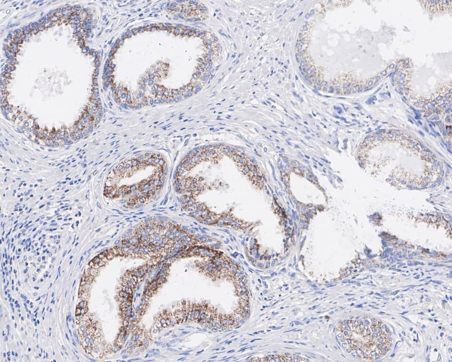 Immunohistochemistry: TXNRD2 Antibody (PSH02-27) [NBP3-33069] - Immunohistochemical analysis of paraffin-embedded human prostate tissue with Rabbit anti-TXNRD2 antibody (NBP3-33069) at 1/200 dilution. The section was pre-treated using heat mediated antigen retrieval with Tris-EDTA buffer (pH 9.0) for 20 minutes. The tissues were blocked in 1% BSA for 20 minutes at room temperature, washed with ddH2O and PBS, and then probed with the primary antibody (NBP3-33069) at 1/200 dilution for 1 hour at room temperature. The detection was performed using an HRP conjugated compact polymer system. DAB was used as the chromogen. Tissues were counterstained with hematoxylin and mounted with DPX.