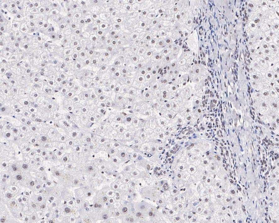 Immunohistochemistry: U2AF2 Antibody (JE36-33) [NBP3-33071] - Immunohistochemical analysis of paraffin-embedded human liver tissue with Rabbit anti-U2AF2 antibody (NBP3-33071) at 1/1,000 dilution. The section was pre-treated using heat mediated antigen retrieval with sodium citrate buffer (pH 6.0) for 2 minutes. The tissues were blocked in 1% BSA for 20 minutes at room temperature, washed with ddH2O and PBS, and then probed with the primary antibody (NBP3-33071) at 1/1,000 dilution for 1 hour at room temperature. The detection was performed using an HRP conjugated compact polymer system. DAB was used as the chromogen. Tissues were counterstained with hematoxylin and mounted with DPX.