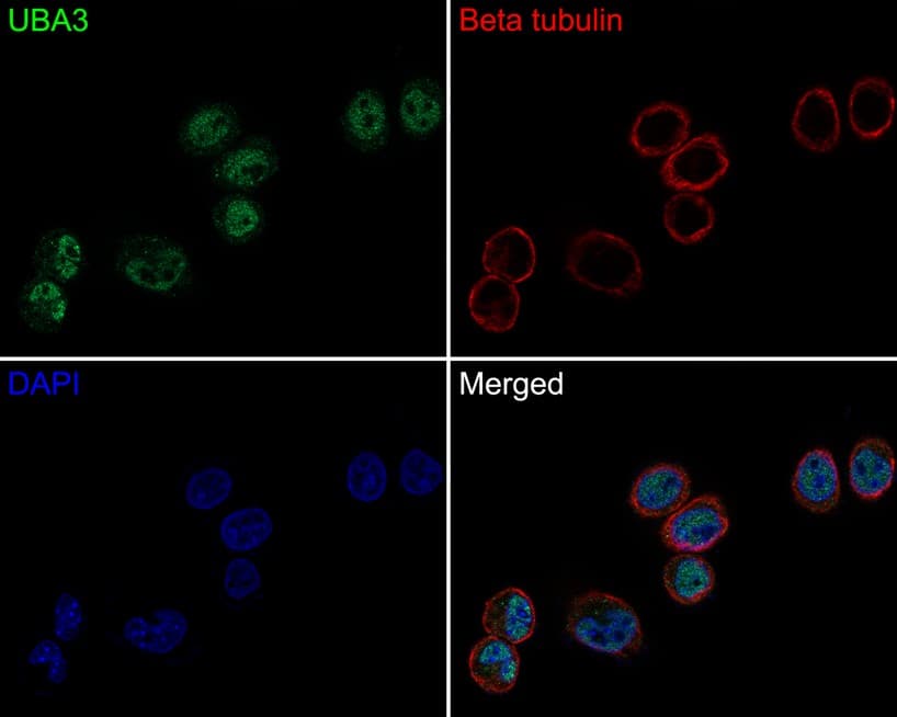 Immunocytochemistry/ Immunofluorescence: UBA3 Antibody (1B5-2-3-R) [NBP3-33072] - Immunocytochemistry analysis of SiHa cells labeling UBA3 with Mouse anti-UBA3 antibody (NBP3-33072) at 1/200 dilution. Cells were fixed in 4% paraformaldehyde for 30 minutes, permeabilized with 0.05% Triton X-100 in PBS for 20 minutes, and then blocked with 2% negative goat serum for 30 minutes at room temperature. Cells were then incubated with Mouse anti-UBA3 antibody (NBP3-33072) at 1/200 dilution in 2% negative goat serum overnight at 4 ℃. Goat Anti-Mouse IgG H&L (iFluor™ 488) was used as the secondary antibody at 1/1,000 dilution. Nuclear DNA was labelled in blue with DAPI. beta Tubulin (red) was stained at 1/100 dilution overnight at +4℃. Goat Anti-Rabbit IgG H&L (iFluor™ 594) were used as the secondary antibody at 1/1,000 dilution.