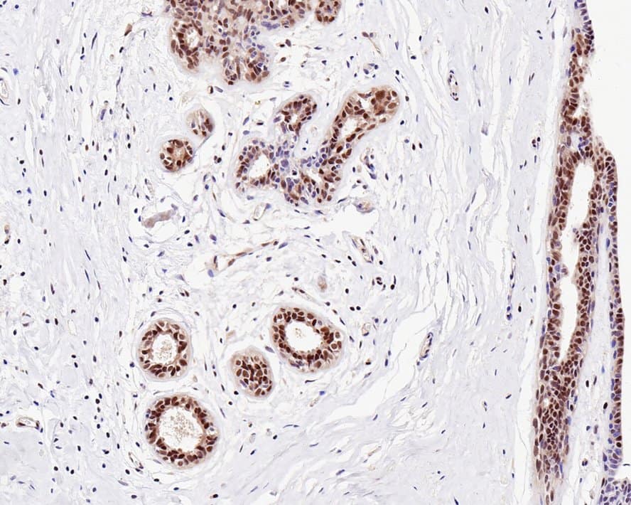 Immunohistochemistry: UBA3 Antibody (1B5-2-3-R) [NBP3-33072] - Immunohistochemical analysis of paraffin-embedded human breast tissue with Mouse anti-UBA3 antibody (NBP3-33072) at 1/1,000 dilution. The section was pre-treated using heat mediated antigen retrieval with sodium citrate buffer (pH 6.0) for 2 minutes. The tissues were blocked in 1% BSA for 20 minutes at room temperature, washed with ddH2O and PBS, and then probed with the primary antibody (NBP3-33072) at 1/1,000 dilution for 1 hour at room temperature. The detection was performed using an HRP conjugated compact polymer system. DAB was used as the chromogen. Tissues were counterstained with hematoxylin and mounted with DPX.