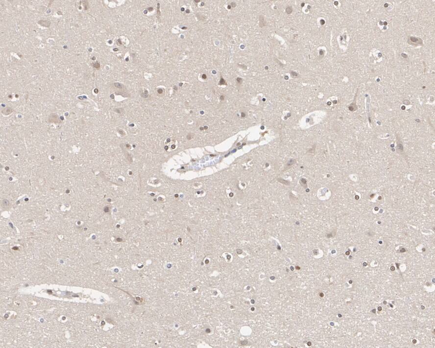 Immunohistochemistry: UBA3 Antibody (1C10-5-5-R) [NBP3-33074] - Immunohistochemical analysis of paraffin-embedded human brain tissue with Mouse anti-UBA3 antibody (NBP3-33074) at 1/500 dilution. The section was pre-treated using heat mediated antigen retrieval with sodium citrate buffer (pH 6.0) for 2 minutes. The tissues were blocked in 1% BSA for 20 minutes at room temperature, washed with ddH2O and PBS, and then probed with the primary antibody (NBP3-33074) at 1/500 dilution for 1 hour at room temperature. The detection was performed using an HRP conjugated compact polymer system. DAB was used as the chromogen. Tissues were counterstained with hematoxylin and mounted with DPX.