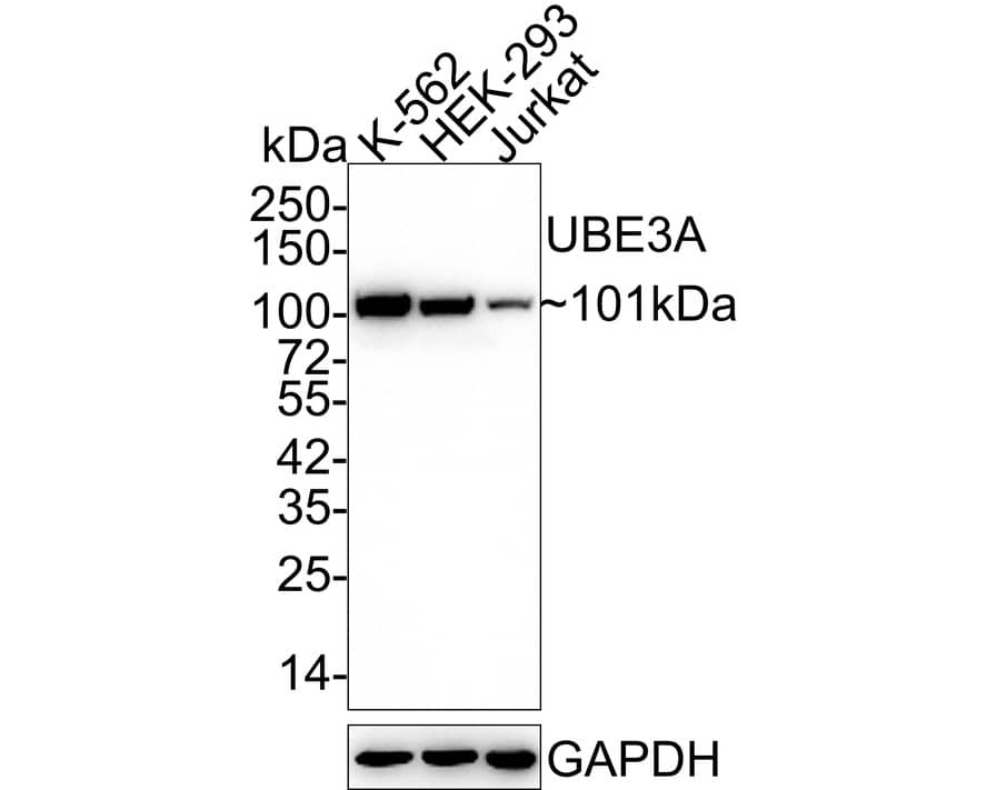 Western Blot: E6AP/UBE3A Antibody (JE32-48) [NBP3-33077] - Western blot analysis of E6AP/UBE3A on different lysates with Rabbit anti-E6AP/UBE3A antibody (NBP3-33077) at 1/1,000 dilution. Lane 1: K-562 cell lysate Lane 2: HEK-293 cell lysate Lane 3: Jurkat cell lysate Lysates/proteins at 30 ug/Lane. Predicted band size: 101 kDa Observed band size: 101 kDa Exposure time: 1 minute 30 seconds; 4-20% SDS-PAGE gel. Proteins were transferred to a PVDF membrane and blocked with 5% NFDM/TBST for 1 hour at room temperature. The primary antibody (NBP3-33077) at 1/1,000 dilution was used in 5% NFDM/TBST at 4C overnight. Goat Anti-Rabbit IgG - HRP Secondary Antibody at 1/50,000 dilution was used for 1 hour at room temperature.