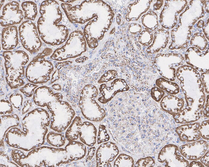 Immunohistochemistry: UQCRC1 Antibody (PSH01-23) [NBP3-33078] - Immunohistochemical analysis of paraffin-embedded human kidney tissue with Rabbit anti-UQCRC1 antibody (NBP3-33078) at 1/5,000 dilution. The section was pre-treated using heat mediated antigen retrieval with Tris-EDTA buffer (pH 9.0) for 20 minutes. The tissues were blocked in 1% BSA for 20 minutes at room temperature, washed with ddH2O and PBS, and then probed with the primary antibody (NBP3-33078) at 1/5,000 dilution for 1 hour at room temperature. The detection was performed using an HRP conjugated compact polymer system. DAB was used as the chromogen. Tissues were counterstained with hematoxylin and mounted with DPX.