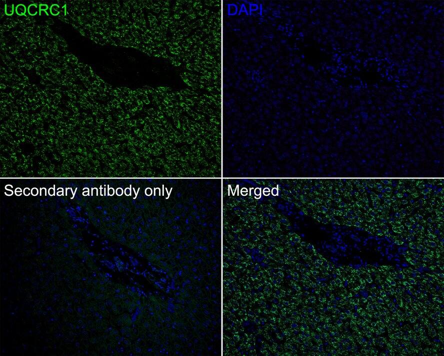 Immunohistochemistry: UQCRC1 Antibody (PSH01-23) [NBP3-33078] - Immunofluorescence analysis of paraffin-embedded human liver tissue labeling UQCRC1 with Rabbit anti-UQCRC1 antibody (NBP3-33078) at 1/1,000 dilution. The section was pre-treated using heat mediated antigen retrieval with Tris-EDTA buffer (pH 9.0) for 20 minutes. The tissues were blocked in 10% negative goat serum for 1 hour at room temperature, washed with PBS, and then probed with the primary antibody (NBP3-33078, green) at 1/1,000 dilution overnight at 4 ℃, washed with PBS. Goat Anti-Rabbit IgG H&L (iFluor™ 488) was used as the secondary antibody at 1/1,000 dilution. Nuclei were counterstained with DAPI (blue).