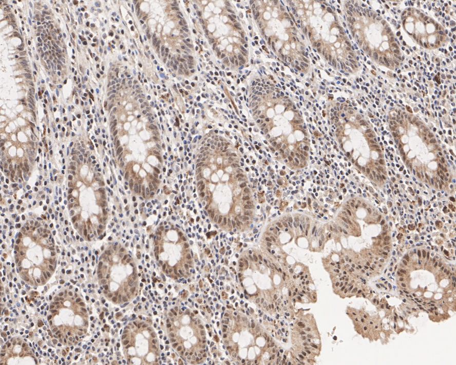 Immunohistochemistry UFSP2 Antibody (PSH03-57)