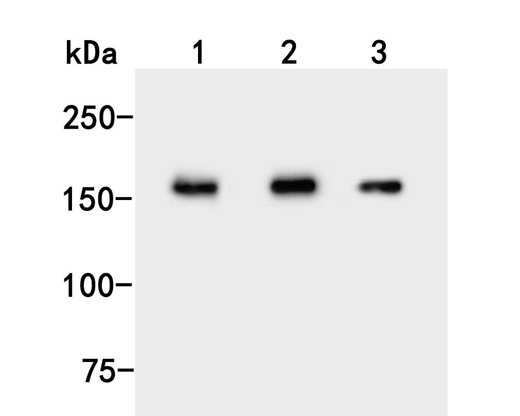 Western Blot UGGT1 Antibody