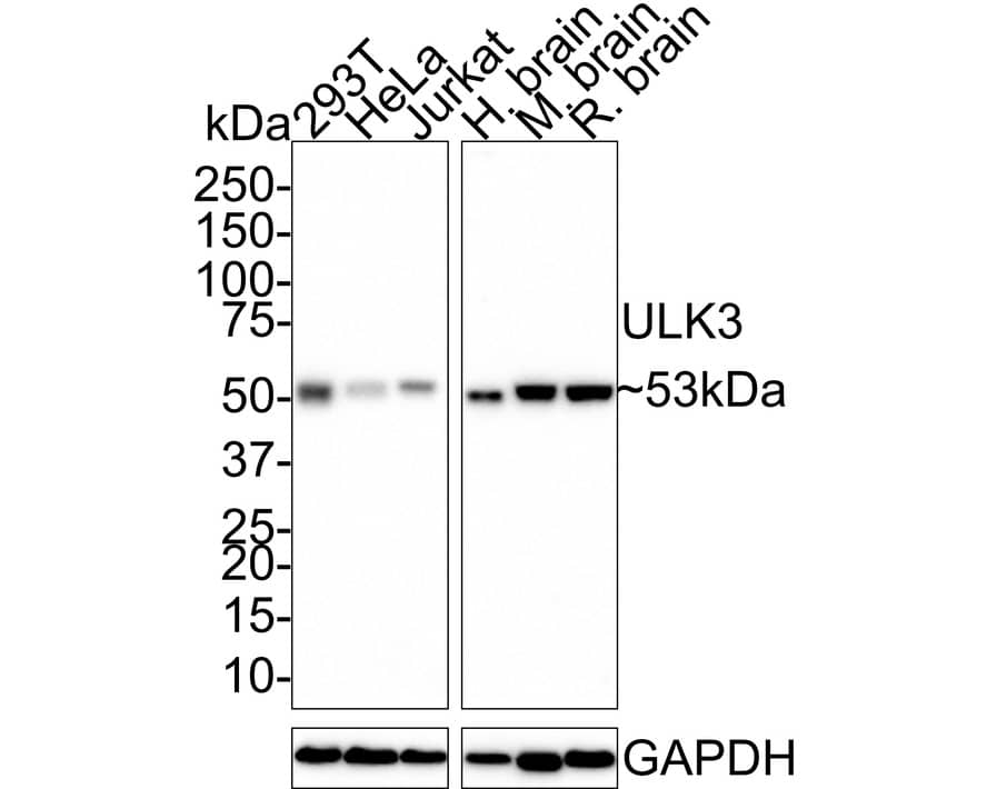 Western blot analysis on different lysates with NBP3-33083 at 1/1,000 dilution. Lane 1: 293T cell lysate (20 µg/Lane) Lane 2: HeLa cell lysate (20 µg/Lane) Lane 3: Jurkat cell lysate (20 µg/Lane) Lane 4: Human brain tissue lysate (40 µg/Lane) Lane 5: Mouse brain tissue lysate (40 µg/Lane) Lane 6: Rat brain tissue lysate (40 µg/Lane) Predicted band size: 53 kDa Observed band size: 53 kDa Exposure time: 3 minutes; 4-20% SDS-PAGE gel. Proteins were transferred to a PVDF membrane and blocked with 5% NFDM/TBST for 1 hour at room temperature. NBP3-33083 at 1/1,000 dilution was used in 5% NFDM/TBST at room temperature for 2 hours. Goat Anti-Rabbit IgG [HRP] Secondary Antibody at 1:100,000 dilution was used for 1 hour at room temperature.