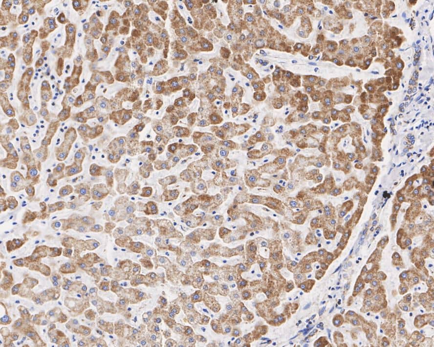 Immunohistochemistry: UQCRC2 Antibody (JE32-56) [NBP3-33085] - Immunohistochemical analysis of paraffin-embedded human liver tissue with Rabbit anti-UQCRC2 antibody (NBP3-33085) at 1/2,000 dilution. The section was pre-treated using heat mediated antigen retrieval with Tris-EDTA buffer (pH 9.0) for 20 minutes. The tissues were blocked in 1% BSA for 20 minutes at room temperature, washed with ddH2O and PBS, and then probed with the primary antibody (NBP3-33085) at 1/2,000 dilution for 1 hour at room temperature. The detection was performed using an HRP conjugated compact polymer system. DAB was used as the chromogen. Tissues were counterstained with hematoxylin and mounted with DPX.