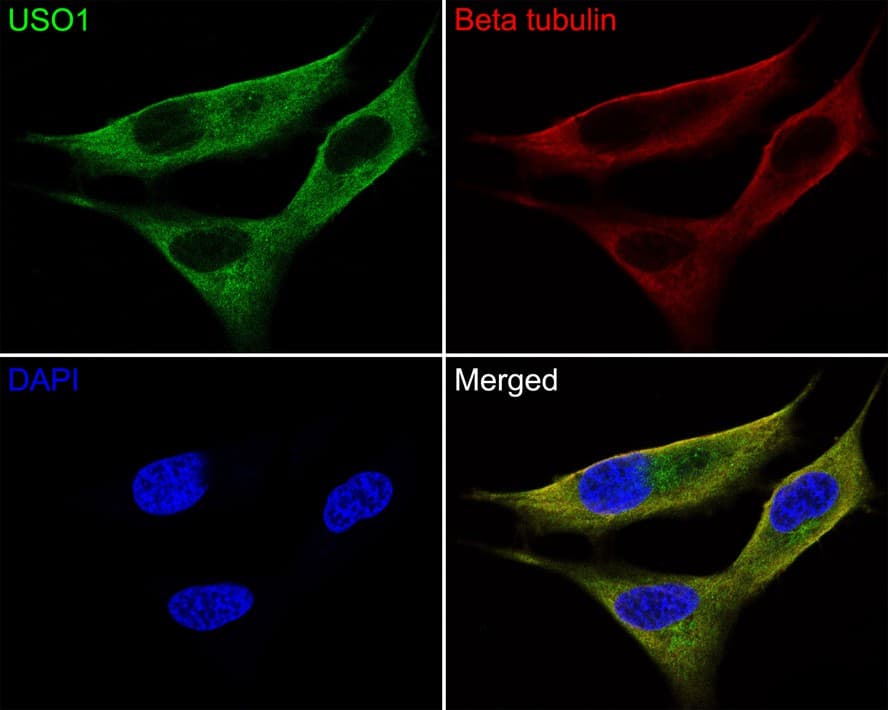 Immunocytochemistry/ Immunofluorescence: VDP p115 Antibody (JE64-48) [NBP3-33087] - Immunocytochemistry analysis of SH-SY5Y cells labeling VDP p115 with Rabbit anti-VDP p115 antibody (NBP3-33087) at 1/50 dilution. Cells were fixed in 4% paraformaldehyde for 10 minutes at 37 ℃, permeabilized with 0.05% Triton X-100 in PBS for 20 minutes, and then blocked with 2% negative goat serum for 30 minutes at room temperature. Cells were then incubated with Rabbit anti-VDP p115 antibody (NBP3-33087) at 1/50 dilution in 2% negative goat serum overnight at 4 ℃. Goat Anti-Rabbit IgG H&L (iFluor™ 488) was used as the secondary antibody at 1/1,000 dilution. Nuclear DNA was labelled in blue with DAPI. Beta tubulin (red) was stained at 1/200 dilution overnight at +4℃. Goat Anti-Mouse IgG H&L (iFluor™ 647) were used as the secondary antibody at 1/1,000 dilution.