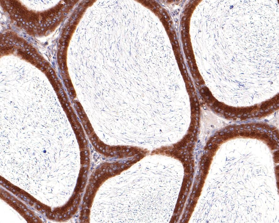 Immunohistochemistry: VDP p115 Antibody (JE64-48) [NBP3-33087] - Immunohistochemical analysis of paraffin-embedded rat epididymis tissue with Rabbit anti-VDP p115 antibody (NBP3-33087) at 1/100 dilution. The section was pre-treated using heat mediated antigen retrieval with Tris-EDTA buffer (pH 9.0) for 20 minutes. The tissues were blocked in 1% BSA for 20 minutes at room temperature, washed with ddH2O and PBS, and then probed with the primary antibody (NBP3-33087) at 1/100 dilution for 1 hour at room temperature. The detection was performed using an HRP conjugated compact polymer system. DAB was used as the chromogen. Tissues were counterstained with hematoxylin and mounted with DPX.