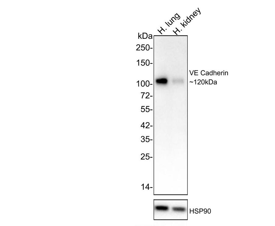 Western blot analysis on different lysates with NBP3-33088 at 1/2,000 dilution. Lane 1: Human lung tissue lysate Lane 2: Human kidney tissue lysate Lysates/proteins at 30 µg/Lane. Predicted band size: 88 kDa Observed band size: 120-140 kDa Exposure time: 1 minutes; 4-20% SDS-PAGE gel. Proteins were transferred to a PVDF membrane and blocked with 5% NFDM/TBST for 1 hour at room temperature. NBP3-33088 at 1/2,000 dilution was used in 5% NFDM/TBST at 4℃ overnight. Goat Anti-Rabbit IgG [HRP] Secondary Antibody at 1/50,000 dilution was used for 1 hour at room temperature.