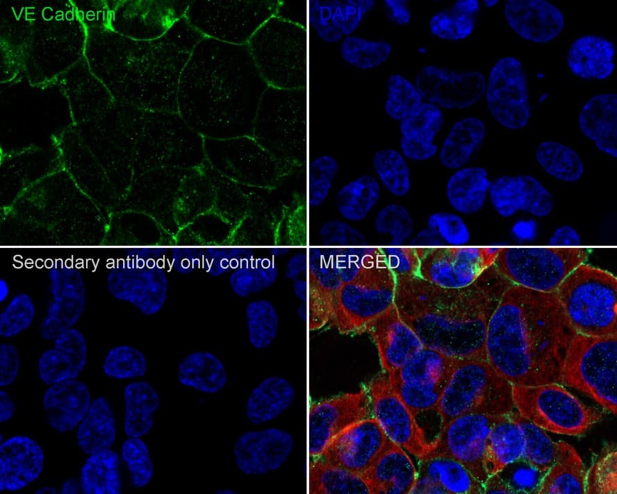 Immunocytochemistry/ Immunofluorescence: VE-Cadherin Antibody (PSH03-15) [NBP3-33088] - Immunocytochemistry analysis of HeLa cells labeling VE-Cadherin with Rabbit anti-VE-Cadherin antibody (NBP3-33088) at 1/100 dilution. Cells were fixed in 4% paraformaldehyde for 20 minutes at room temperature, permeabilized with 0.1% Triton X-100 in PBS for 5 minutes at room temperature, then blocked with 1% BSA in 10% negative goat serum for 1 hour at room temperature. Cells were then incubated with Rabbit anti-VE-Cadherin antibody (NBP3-33088) at 1/100 dilution in 1% BSA in PBST overnight at 4 ℃. Goat Anti-Rabbit IgG H&L (iFluor™ 488) was used as the secondary antibody at 1/1,000 dilution. PBS instead of the primary antibody was used as the secondary antibody only control. Nuclear DNA was labelled in blue with DAPI. Beta tubulin (red) was stained at 1/100 dilution overnight at +4℃. Goat Anti-Mouse IgG H&L (iFluor™ 594) was used as the secondary antibody at 1/1,000 dilution.