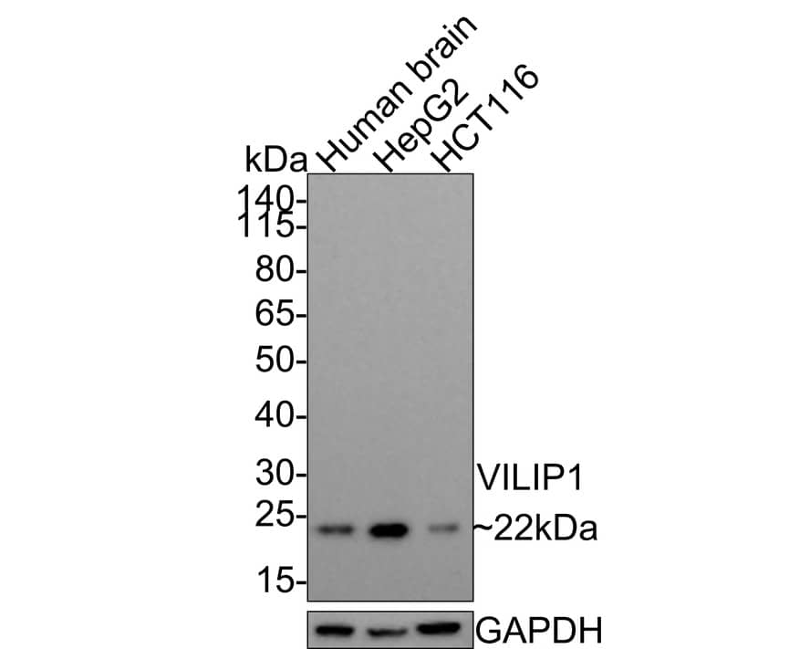Western Blot: visinin-like 1 Antibody (PSH0-08) [NBP3-33089] - Western blot analysis of visinin-like 1 on different lysates with Rabbit anti-visinin-like 1 antibody (NBP3-33089) at 1/1,000 dilution. Lane 1: Human liver tissue lysate (20 ug/Lane) Lane 2: Hela cell lysate (10 ug/Lane) Lane 3: Hela cell lysate (10 ug/Lane) Predicted band size: 22 kDa Observed band size: 22 kDa Exposure time: 3 minutes; 4-20% SDS-PAGE gel. Proteins were transferred to a PVDF membrane and blocked with 5% NFDM/TBST for 1 hour at room temperature. The primary antibody (NBP3-33089) at 1/1,000 dilution was used in 5% NFDM/TBST at room temperature for 2 hours. Goat Anti-Rabbit IgG - HRP Secondary Antibody at 1:300,000 dilution was used for 1 hour at room temperature.